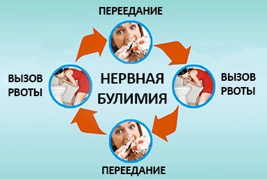 Лечение булимии в Плесецке